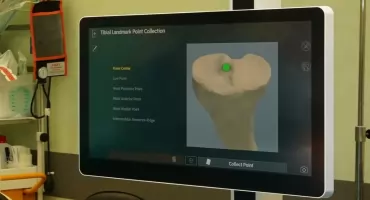 Szpital Uniwersytecki nr 1: pierwsze operacje z robotem CORI