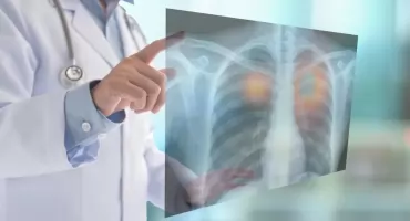 Światowy Dzień Raka Płuca: 84% operacji małoinwazyjnie w Bydgoszczy